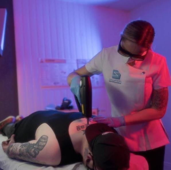 salvation-laser-tattoo-removal-5